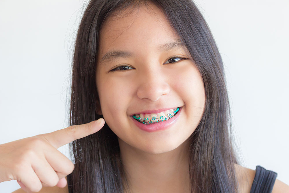 ดูแลความสะอาดช่องปาก ระหว่างจัดฟัน ด้วยน้ำยาบ้วนปาก